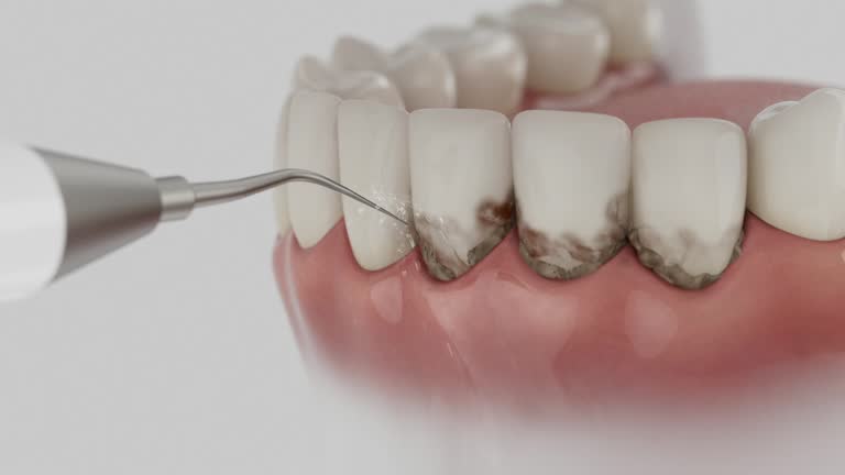 Trusted Root Canal Treatment service in Gary, IN - Dentist Open Now